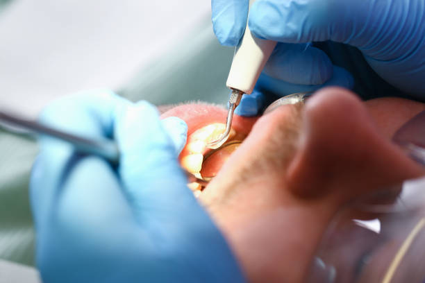 Best Emergency Dental Care for Trauma or Injury in Toledo, IL