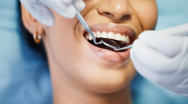 Best Emergency Dental Care for Trauma or Injury in Toledo, IL